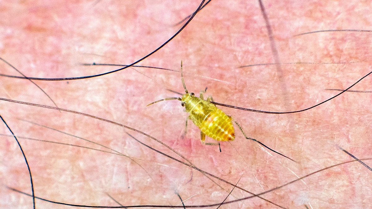 early instar nymph [Miridae sp.?]