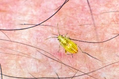 early instar nymph [Miridae sp.?]
